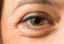 Πρησμένα μάτια: Αιτίες και πώς να απαλλαγείτε